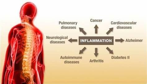 Flamasil™- for Healthy Inflammation Response* | Multi-Herbal Pain Reliever* and Joint Aid | Bio-Enhanced Turmeric, Boswellia, Resveratrol, and More | 13-in-1 Superfood Antioxidants | 30-Day Supply