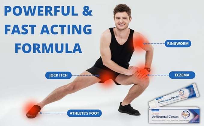Seborrheic Dermatitis & Folliculitis Antifungal Cream: Suitable for Scalp & Body, Supports Perioral Dermatitis, Back Fungal Acne, Ringworm, Athlete’s Foot & Jock Itch, 1 oz