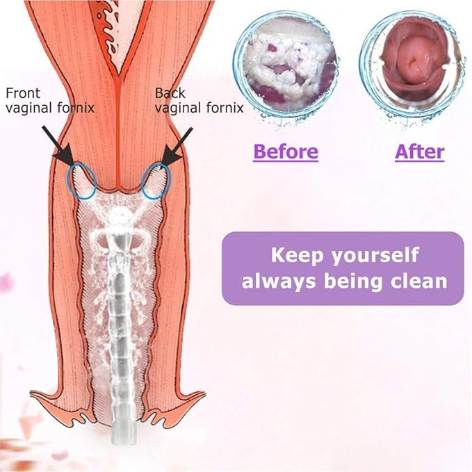 Reusable Vaginal Cleansing System Excellent Vaginal Cleanser Female Vaginal Rinse, Manual Pressure Clean, 100% Safe, 300 ml Capacity Extra 2 Nozzle Tips Doctor Recommended (300ml)