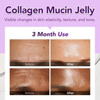 Glow, 1200mg Snail Mucin Supports Skin Elasticity, Collagen Peptides Jelly Stick, Kiwi Flavor, Biotin, Vitamin C, Hyaluronic Acid, Prebiotics, Korean Skin Care, 10 Sticks