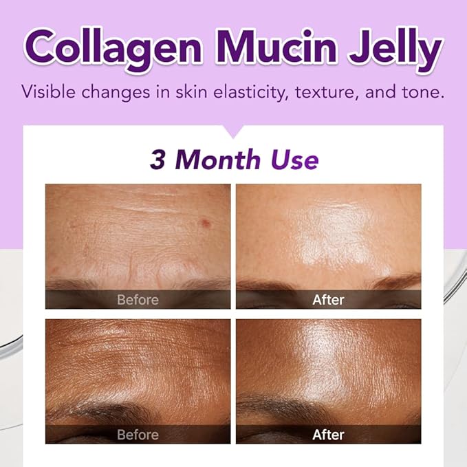 Glow, 1200mg Snail Mucin Supports Skin Elasticity, Collagen Peptides Jelly Stick, Kiwi Flavor, Biotin, Vitamin C, Hyaluronic Acid, Prebiotics, Korean Skin Care, 10 Sticks