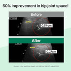 Doctor.By Hip&Joint Swift for Dogs - Advanced Joint & Cartilage Support Supplement with Green-Lipped Mussel Oil, Eggshell Membrane 120 Soft Gels