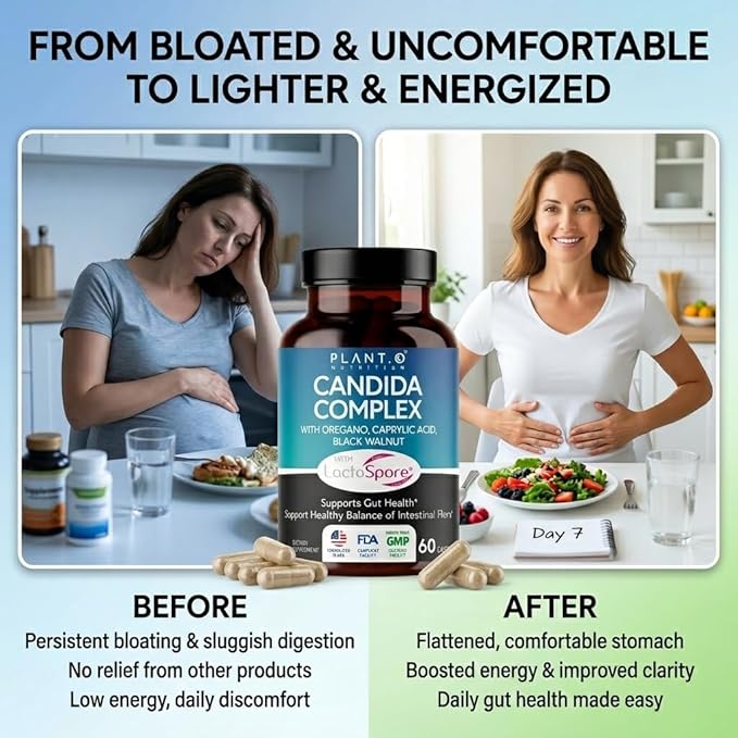 Candida Cleanse Supplement, Yeast Cleanse & Candida Support with Probiotics (LactoSpore®), Oregano Oil, Caprylic Acid, Black Walnut – Gut Health, Digestive Cleanse, Flora Balance – 60 Capsules