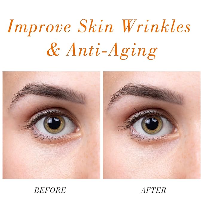 Organic Rosehip Oil for Face & Skin – USDA Certified, Cold Pressed, Unrefined Rose Hip Seed Oil for Anti-Aging, Scars, Moisturizing, Hair, Nails & Gua Sha Massage, 2 fl oz (60 ml)