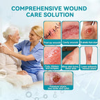 Dimora Calcium Alginate Wound Dressing, 4'' x 4'' Patches, 20 Individual Sterile Bandages, Soft and Highly Absorbent Dressing Gauze, Non-Stick Padding