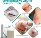 Dimora Upgrade Silver Calcium Alginate Wound Dressing -Antibacterial Non Stick Gauze for Wounds Care, Highly Absorbent Sterile Bandage Pads with Ag, 2'' x 2'' Patches 12 Packs Individual