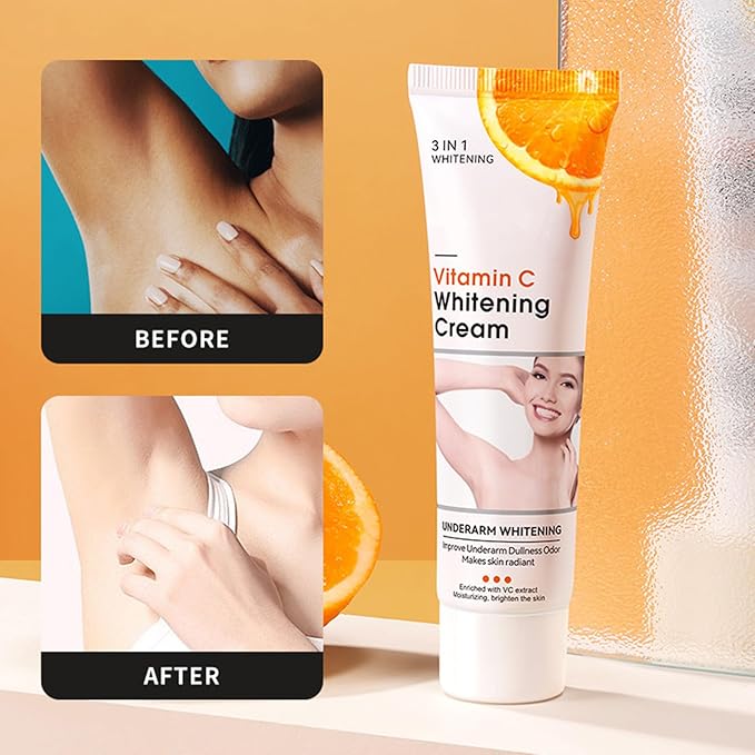 Vitamin C Skin Whitening Cream,Dark Spot Remover for Face,Skin Lightening Cream for Intimate Areas,Neck,Armpit,Elbow, Inner Thigh and Knees,Improve Underarm Dullness Odor