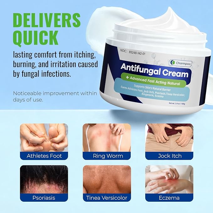 Antifungal Cream for Jock Itch: 2% Miconazole and Herbal Formula for Itchy Skin Relief Extra Strength - Cures Ringworm Athletes Foot Tinea Versicolor 100g