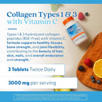 Doctor's Best Collagen Peptides Types 1 & 3 - Collagen Supplement for Women & Men, Supports Hair, Skin, Nails, & Joint Health, Includes 30 mg Vitamin C & 3 g Protein Per Serving, Non GMO - 180 Tablets