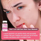 2 Pack L-Lysine Gummies 1000mg, Lysine Gummies Supplement for Adults & Kids, Essential Amino Acid with L-Arginine, L-Glutamine for Lip & Skin, Immune, Calcium Absorption, Strawberry Flavor, 120Ct