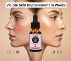 Earth N Pure Rosehip Oil Cold Pressed, Natural and Therapeutic Grade for Face with Glass Dropper - 100 ml