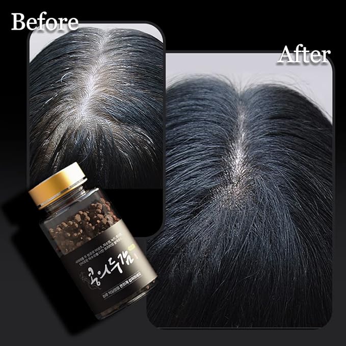 ROOTONIX Korean Hair Growth Supplement for Thin Hair – Thickening Herbal Black Bean Extract Pellet Complex + Hasuo for Thicker, Fuller, Stronger, Longer Hair – Prevents Thinning, Hair Loss, Grays