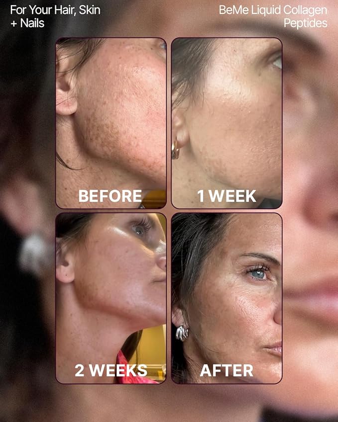 BeMe Liquid Collagen for Women - 2500mg Verisol Collagen Liquid with Biotin, CoQ10 & Vitamin C - Clinically Proven Collagen Peptides for Hair, Skin & Nails - 15 Mixed Berry Sachets