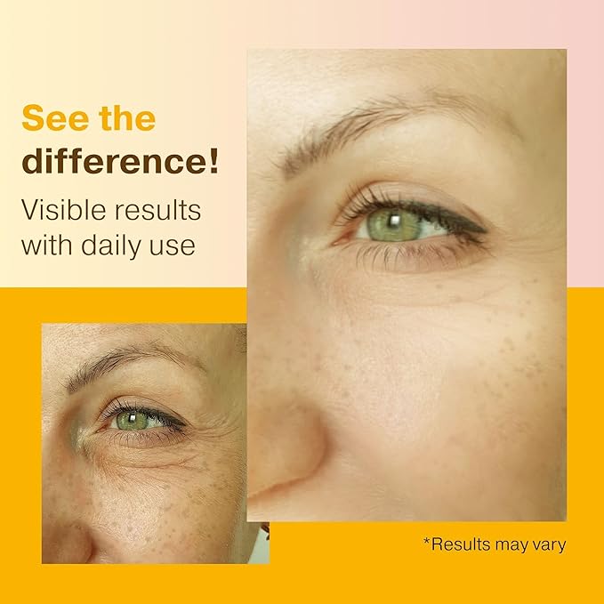 Double Size (2OZ) Super Vitamin C Serum for Face, Niacinamide Serum, 5% Vitamin C Face Serum, Hyaluronic Acid, Resveratrol, Anti-Aging Brightening