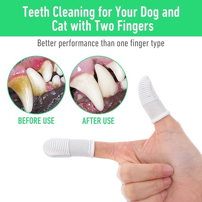 YUIANLB 20 Pcs Pet Dental Care Kit Finger Toothbrush Oral Cleaning Wipes Soft Washable Fabric Freshens Breath Reduces Plaque Tartar Complete Oral Hygiene Set for Puppies Kittens at Home