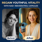 NAD+ Supplement - NAD Supplements for Women & Men - Liposomal NAD+ Resveratrol Complex with Urolithin A, CoQ10 - Boosts NAD+ Levels, Cellular Energy & Healthy Skin - Third-Party Tested - 60 Capsules