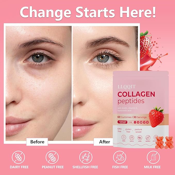 60 Count Multi-Collagen Peptides Gummies for Women - Packed with Types I, II, III, V, X, Vitamins C, E, Zinc & Hyaluronic Acid - Non-GMO & Gluten Free