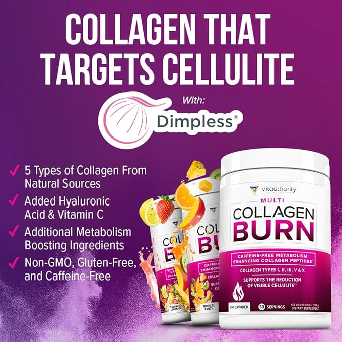Vitauthority Collagen Peptides Powder Weight Loss Supplements | Hydrolyzed Beauty Complex for Women, Hair Skin Nails | Fat Burning Support | Chocolate Flavored 25 Servings