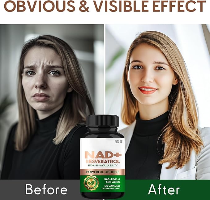 NAD+ Resveratrol Supplement 120 Capsules, Supports Healthy Aging, Cellular Energy, Metabolism & Brain Boost for Men & Women
