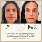 Happy Aging Liquid NAD+ Resveratrol Supplement, NMN Alternative, Liposomal Nicotinamide Riboside & Antioxidants for Energy Support, Brain Health, Firm Skin, Twice Weekly Use, 30 Shots