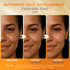 QOOQ Turmeric Kojic Acid Soap for Dark Spots Remover – Facial Cleansing Bar with Vitamin C, Retinol, Collagen, Vitamin E, Glycerin, Shea Butter & Castile Olive Oil – Soap for Women & Men (100g)
