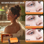 Kojic Acid Soap for Dark Spot Remover Bars with Turmeric, Vitamin C, Retinol, Collagen with Hyaluronic Acid, Vitamin E, Shea Butter, Castile Olive Oil - 3.52 OZ x 2 Bars with Bag