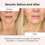 Glov Beauty NAD+ Supplement Capsules - Skin Rejuvenation with Resveratrol, Urolithin A & CoQ10, NAD Supplements for Women 40+, NAD Plus for Healthy Aging, Radiant Skin & Cellular Energy, 60 Veg Caps