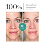 Algenist GENIUS Liquid Collagen Essence - Liquid Collagen Serum with Patented Alguronic Acid to Help Improve Skin Bounce, Elasticity & Radiance (100ml)