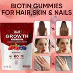 Lumin Hair Growth Gummies – with Biotin, Vitamin C & E, Rosemary, Saw Palmetto – Supports Healthy Hair Growth & Strength, Skin & Nail Care – Mixed Berry Flavor, 60 Gummies (1)