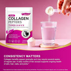 Multi Collagen Peptides Powder - Types I, II, III, V, X – Grass Fed, Pasture Raised - Supports Skin, Hair, Nails & Joints - Flavorless, Hydrolyzed, Easy to Mix - Non-GMO, Gluten-Free, Dairy-Free