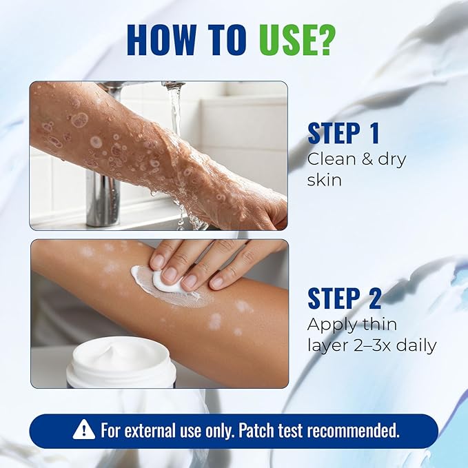 Antifungal Cream for Jock Itch: 2% Miconazole and Herbal Formula for Itchy Skin Relief Extra Strength - Cures Ringworm Athletes Foot Tinea Versicolor 100g