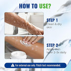 Antifungal Cream for Jock Itch: 2% Miconazole and Herbal Formula for Itchy Skin Relief Extra Strength - Cures Ringworm Athletes Foot Tinea Versicolor 100g