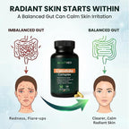 Candida Complex with Caprylic Acid for Men & Women – Anti Overgrowth, Balance and Restore Supplement for Yeast, Healthy Gut Flora & Skin with 30B/g Probiotic, Oregano, Senna - 1 Month Supply
