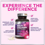 Multi Collagen Peptides Complex - Advanced Hydrolyzed Collagen Supplement Pills with Type I, II, III, V & X - Hair, Skin, Nail & Joint Support Supplement for Women & Men - USA Bottled - 120 Capsules