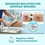 Dimora Calcium Alginate Wound Dressing, 4'' x 4'' Patches,10 Individual Sterile Pads, Soft and Highly Absorbent Dressing Gauze, Non-Stick Padding