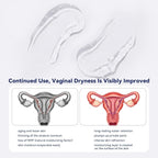 Vaginal Moisturizer, Moisturizing Vaginal Gel with 14mg Hyaluronic Acid-Natural, Gentle Hydration, Hormone-Free Gel for Dryness Relief & pH Balance (12pack)
