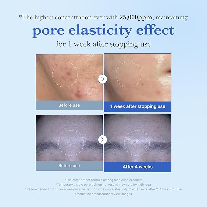 medicube Exosome Shot Zero 25,000 PPM Spicule Facial Serum | Liquid Skin Booster Serum | Exosome, AHA+BHA+PHA | Pore Care, Dead Skin Cells, Skin Texture | Korean Skincare, 0.43 fl.oz