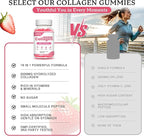 2 Pack Collagen Gummies for Women Men, Hydrolyzed Collagen Peptide Type I,II,III,V,X with Biotin, Vitamin C A B D E for Skin Hair Nails J0ints, Immunity Energy Digestion, Sugar Free, 120 Count