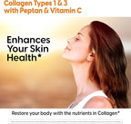 Doctors Best Collagen Types 1 and 3 & Vitamin C, Supports Hair, Skin, Nails, Bones, & Joints, Non-GMO, Gluten Free, Soy Free 540 Tablets