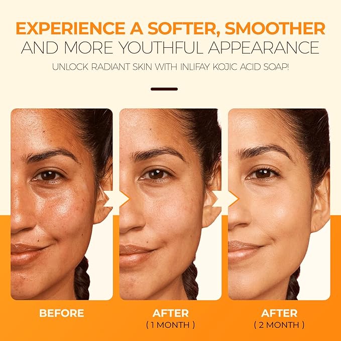 Inlifay Turmeric Kojic Acid Soap: Dark Spot Soap for Face Body - Home Travel Use Skin Cleansing for Women (200g)