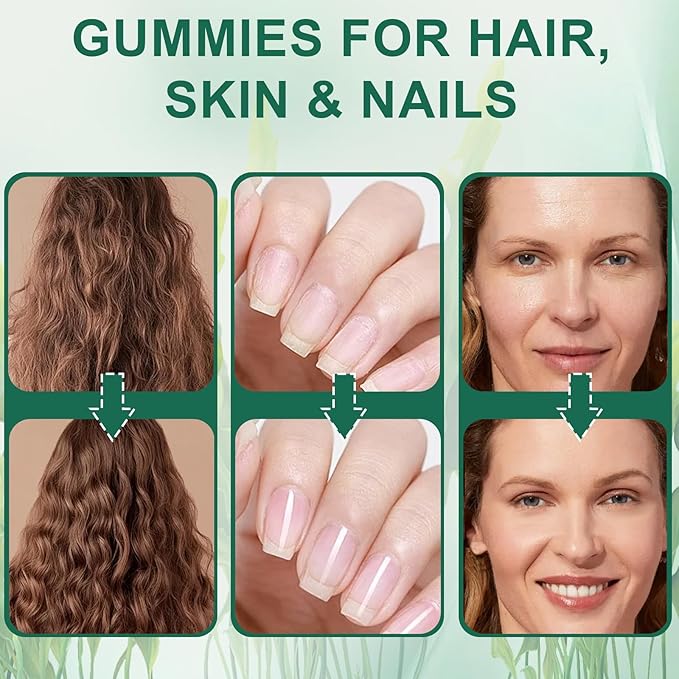 Hair Loss Gummies,Sea Moss Gummies with Vitamin C, Vitamin E, Aloe Vera, Pearl Powder Support Faster Hair Growth,Enhance Nail Elasticity,Promot Radiant Skin,Gluten-Free - 60 Count
