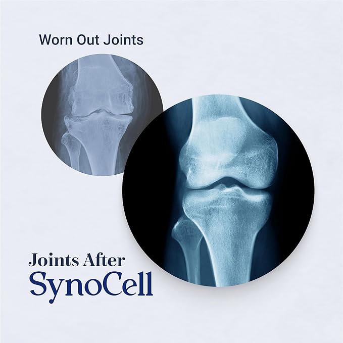 Synocell Glucosamine Chondroitin Complex Back, Neck, and Joint Support Supplement with Boswellia, Quercetin, & MSM - Renew Your Joints from the Inside Out - Move with Freedom and Ease