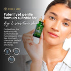 Tree of Life Beauty Hyaluronic Acid Serum, Skin Brightening Face Oil for Dark and Age Spots, Facial Serums for Dry and Sensitive Skin Care with Vitamin E for Soft Smooth Skin, 1 Fl Oz