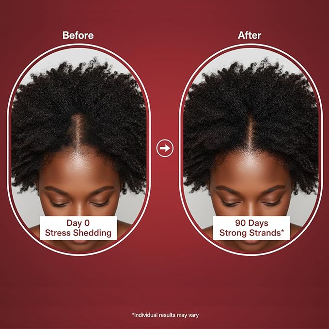 Growth Gummies for Black Women, 60 Vegan Gummies, Daily Hair Nourishment with Biotin, Collagen & Botanical Extracts, Supports Healthy Hair Growth & Strength