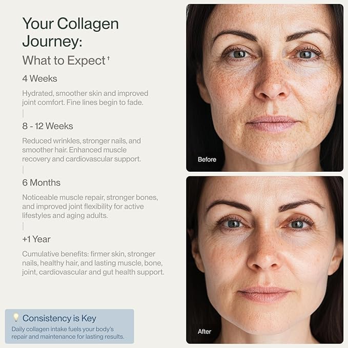 CollaVita Collagen Peptides Powder (3 Month Supply) Grass-Fed Pasture-Raised Hydrolyzed Collagen Powder, Type I & III Hair, Nails, Skin & Joints, Non-GMO, Paleo & Keto, Unflavored, 32 oz. 90 Servings