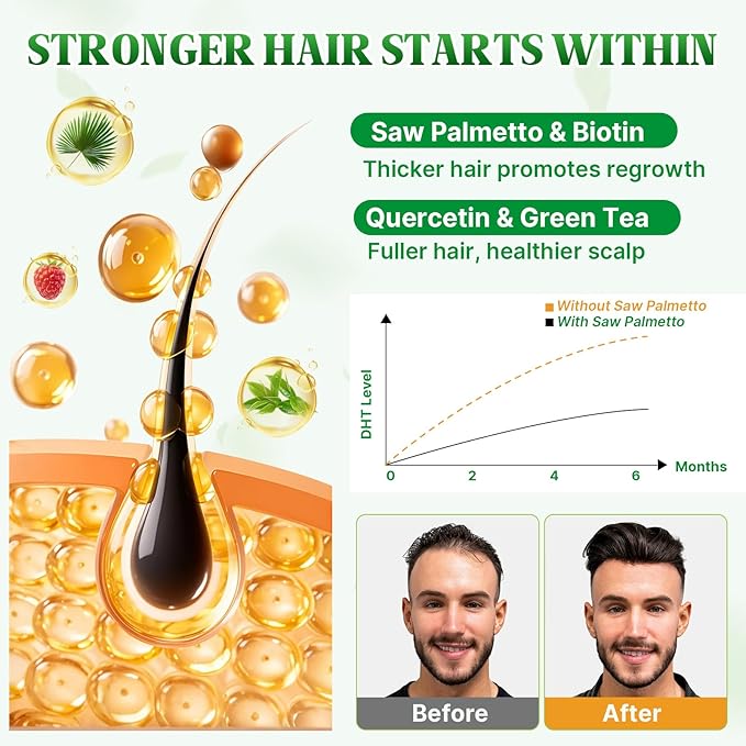 Saw Palmetto Gummies 600mg Saw Palmetto Supplement with Pumpkin Seed Oil, Biotin, Prostate Health Supplements for Men, Advanced DHT Blocker, Hair & Urinary Health Support, Raspberry Flavor, 120 Counts