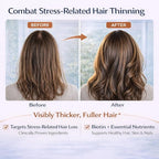 Biotin Hair Skin Nails Gummies: Daily Beauty Supplement for Women Experiencing Stress-Related Hair Thinning, Supports Strong Nails & Healthy Skin, 60 Count, Strawberry Flavor