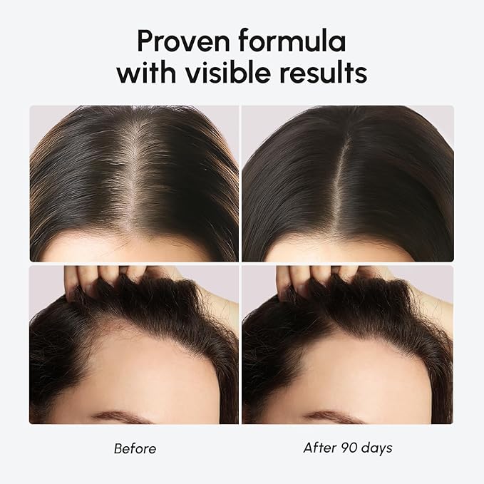 MAREE Hair Growth Vitamins - Faster Thicker Hair Growth Products - Biotin & Collagen Complex Hair Growth Supplements - Hair Vitamins for Hair Loss for Women & Men - Vitaminas Para El Cabello 120 Pills
