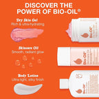Bio-Oil Moisturizing Body Lotion for Dry Skin, Ultra-Lightweight High-Oil Hydration, with Jojoba Oil, Rosehip Oil, Shea Oil, and Hyaluronic Acid, 8.5 Oz