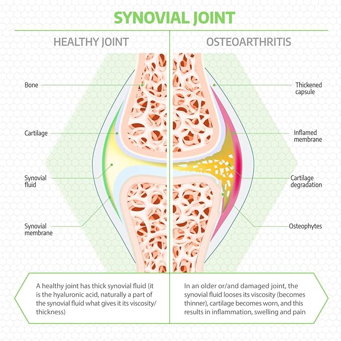 Fluid Motion - Hip & Joint Support for Dogs - Liquid Hyaluronic Acid - Mobility, Comfort and Joint Supplement for Senior Dogs - Apple Flavor - Glucosamine Alternative (60-120+ Day Supply)
